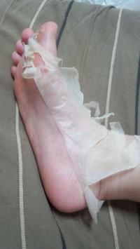 BabyFoot足裏ズル剥け