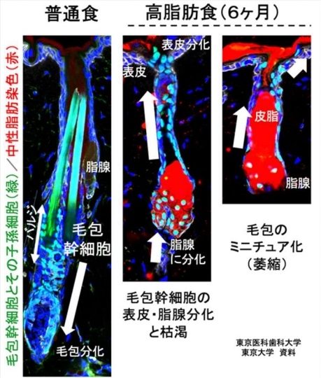食べ物に脂肪が多いと脱毛が進む