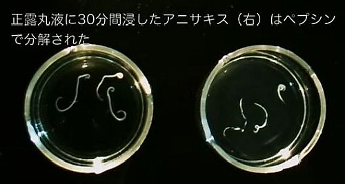 アニサキスに効く正露丸の飲み方